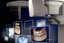Oral and dental imaging